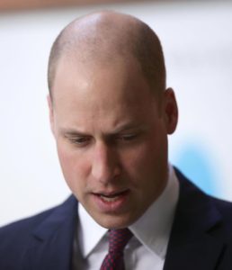 Prince William shaves hair to embrace his hairloss